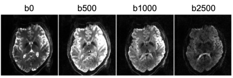 Towards entry "Exciting News: Funding Secured for Cutting-Edge MRI Research Project!"