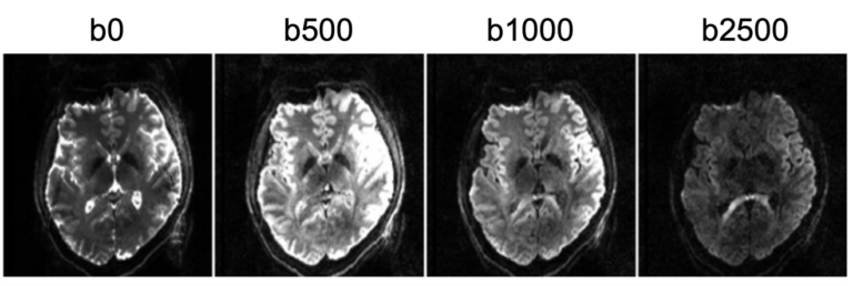 Exciting News: Funding Secured for Cutting-Edge MRI Research Project!