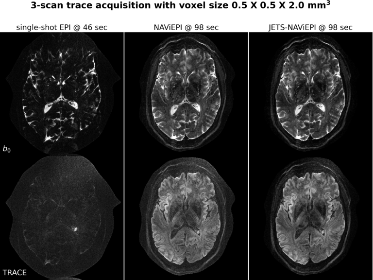New publication in Imaging Neuroscience