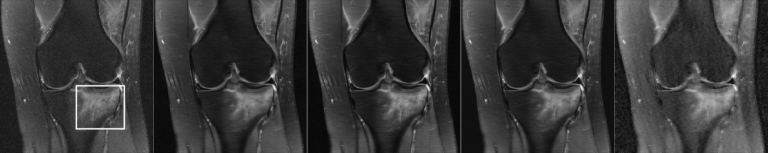 New publication in Radiology