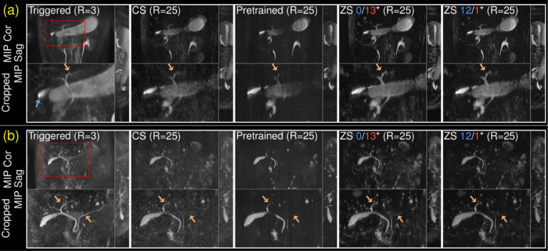 New publication in Magnetic Resonance in Medicine